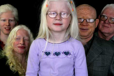 albino-family
